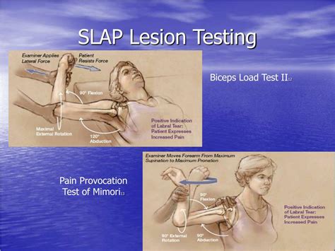 slap lesion special tests